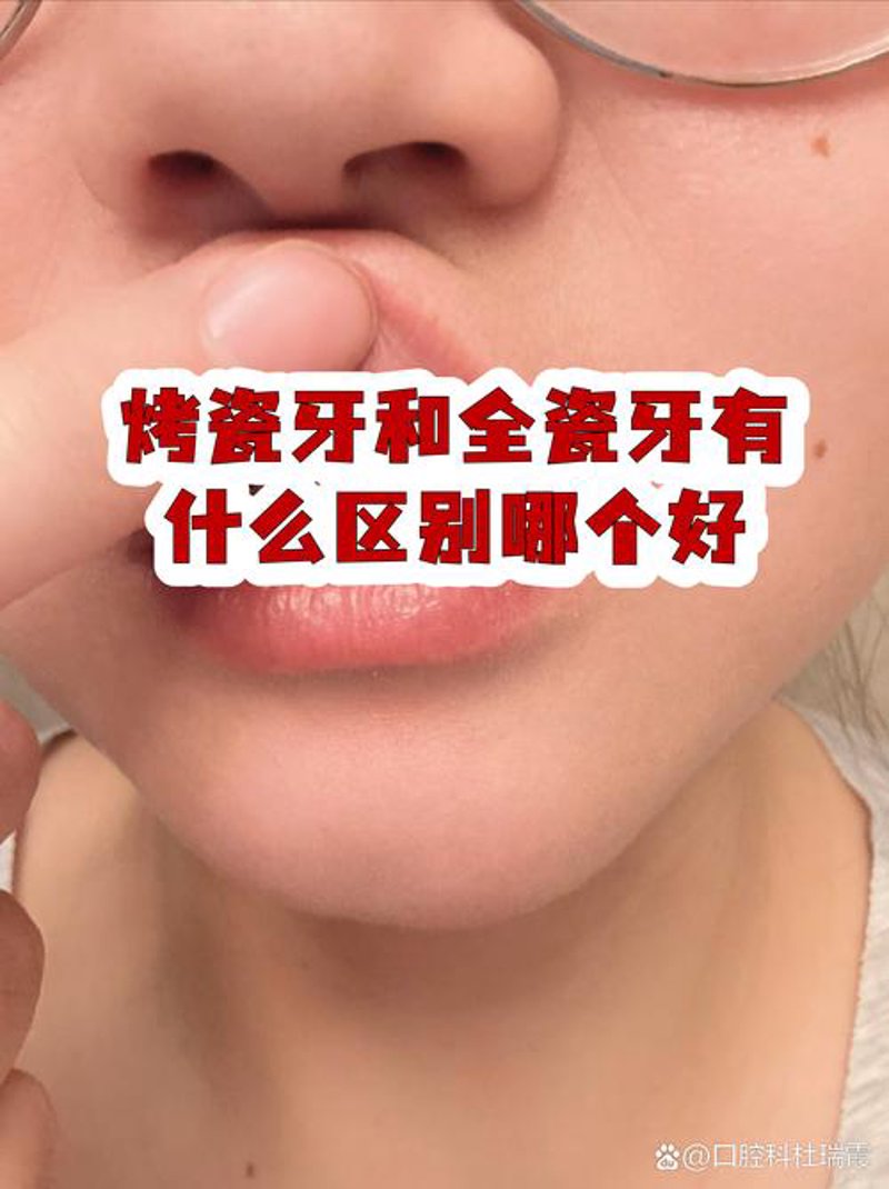 牙齿种植
